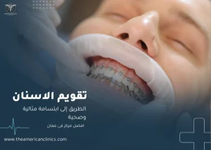 تقويم الأسنان