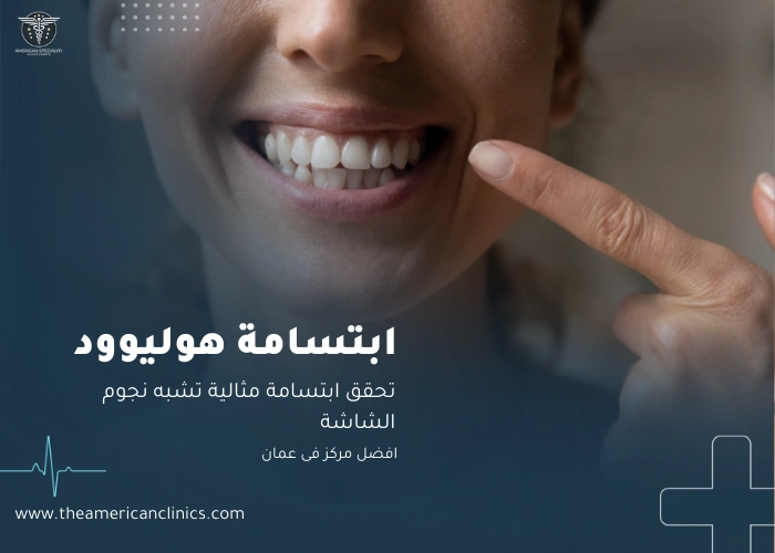 ابتسامة هوليوود