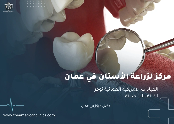 مركز لزراعة الأسنان في عمان مركز لزراعة الاسنان في عمان