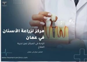 مركز لزراعة الاسنان في عمان