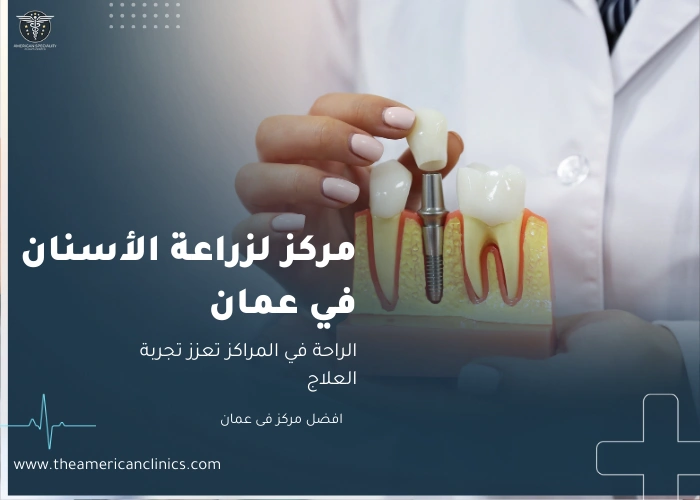 مركز لزراعة الاسنان في عمان