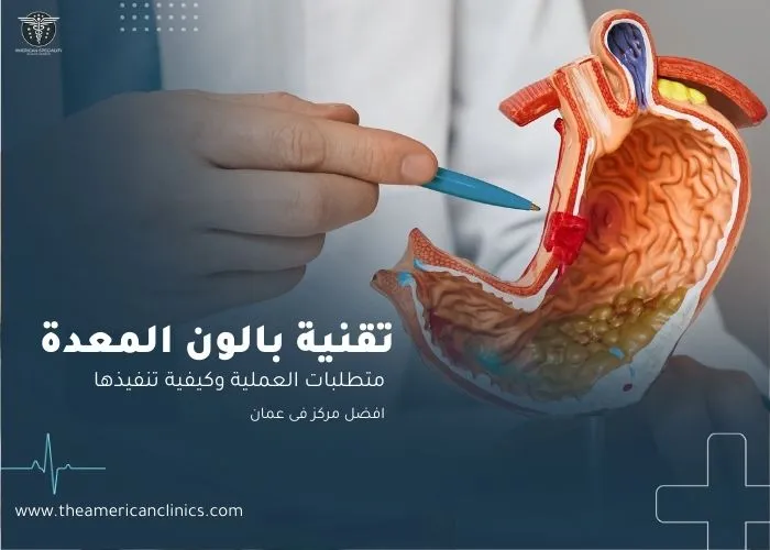 تقنية بالون المعدة في عمان