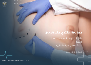 معالجة التثدي عند الرجال