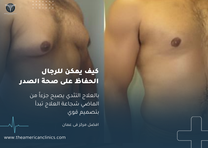 معالجة التثدي عند الرجال كيف يمكن للرجال الحفاظ على صحة الصدر