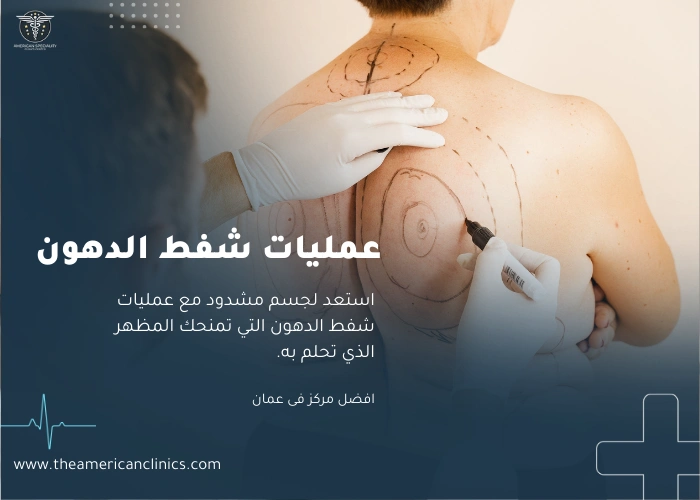 عمليات شفط الدهون