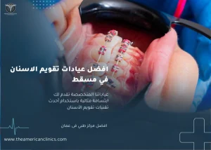 افضل عيادات تقويم الاسنان في مسقط