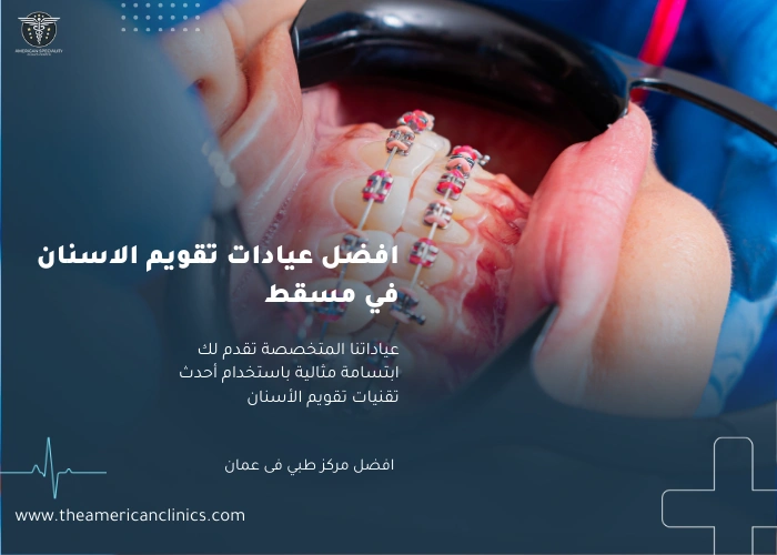 افضل عيادات تقويم الاسنان في مسقط