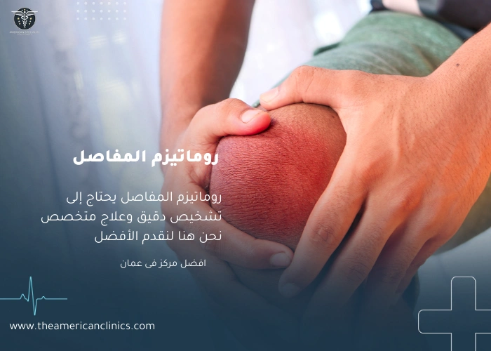 روماتيزم المفاصل