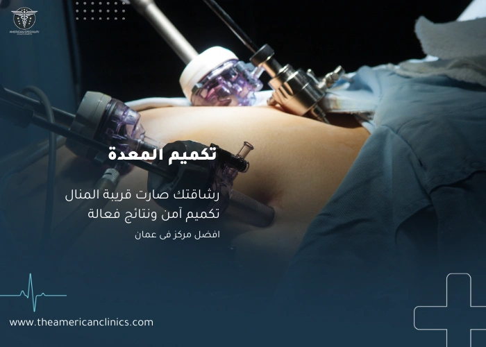 تكميم المعدة