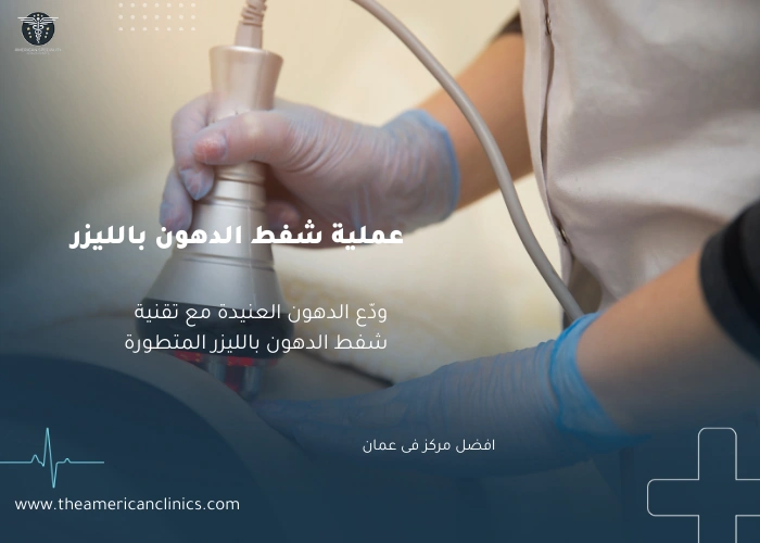 عملية شفط الدهون بالليزر