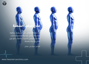 علاج مرض السمنة